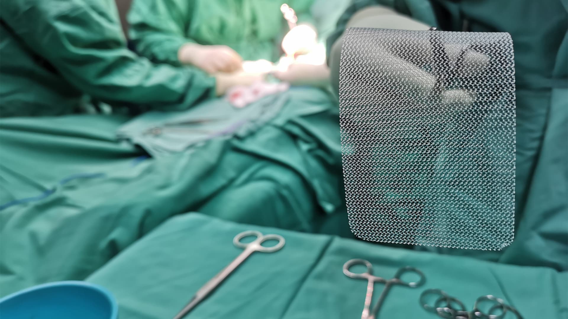 Prolene mesh